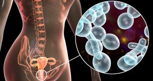 خلل توازن البكتيريا الطبيعية في المهبل