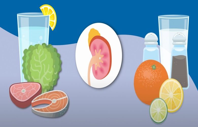 5 عادات تساعد في الحد من تكرار الإصابة بحصى الكلى