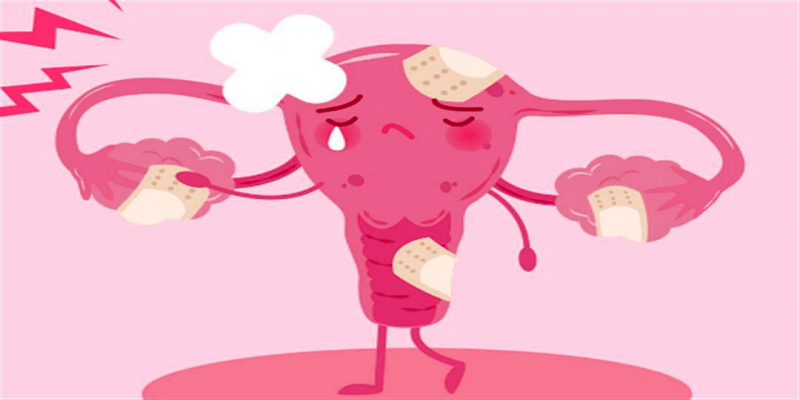 أزمة اضطرابات الإباضة