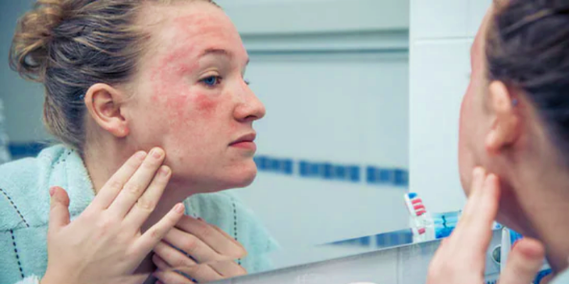 أسباب الإصابة بالتهاب الجلد التأتبي مع حلول الطقس البارد