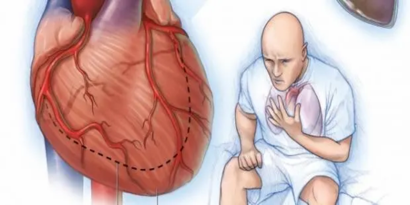 أسباب الإصابة&nbsp;بفشل القلب