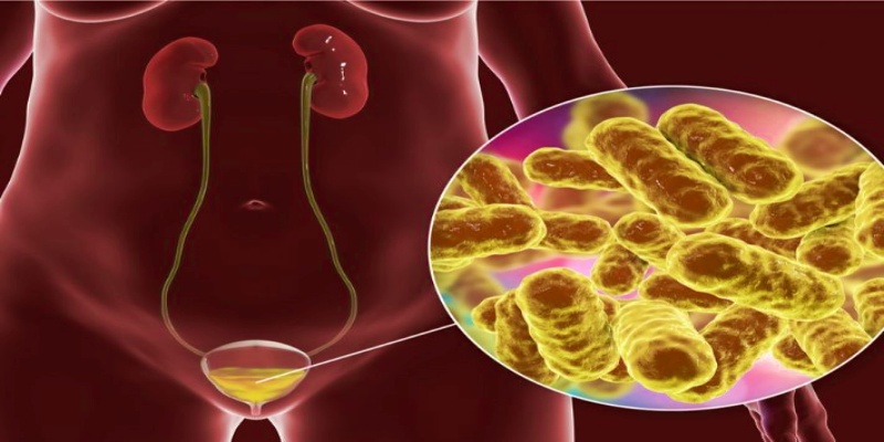أسباب المعاناة من التهاب المثانة الحاد