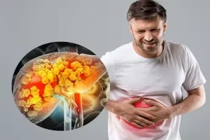 أعراض الكبد الدهني المرتبط بخلل التمثيل الغذائي