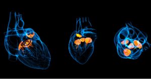 أمراض صمامات القلب