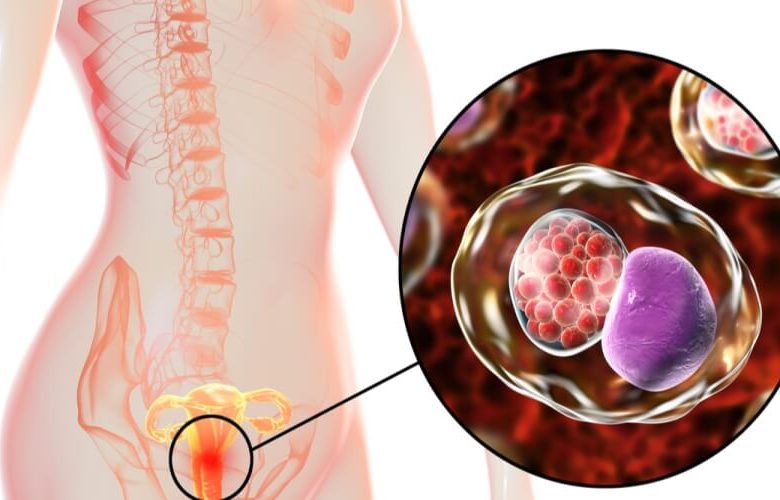 أنواع العدوى المؤثرة على خصوبة النساء