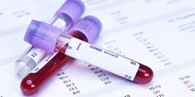 إجراء تحاليل الدم الروتينية