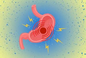 ارتشاح الأمعاء