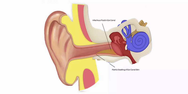 الاضطرابات الدهليزية