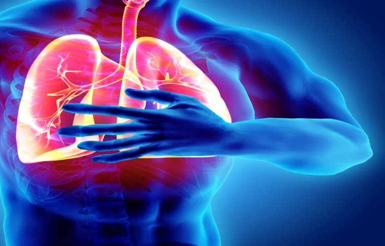 التليف الرئوي: الأسباب والأعراض وأنماط العلاج