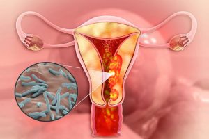 السل التناسلي