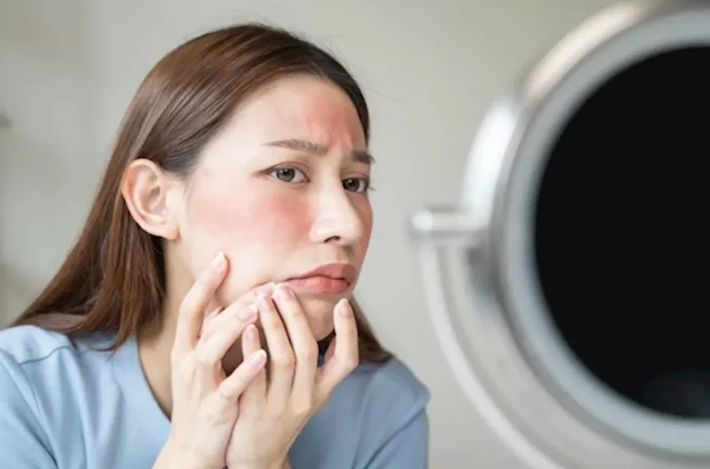 العلاقة بين الغدة الدرقية وانتفاخ الوجه