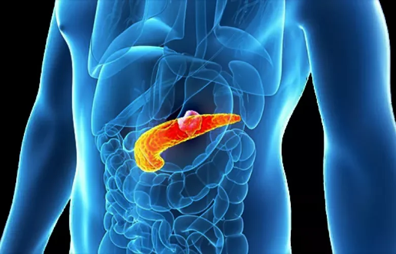 تكيسات البنكرياس
