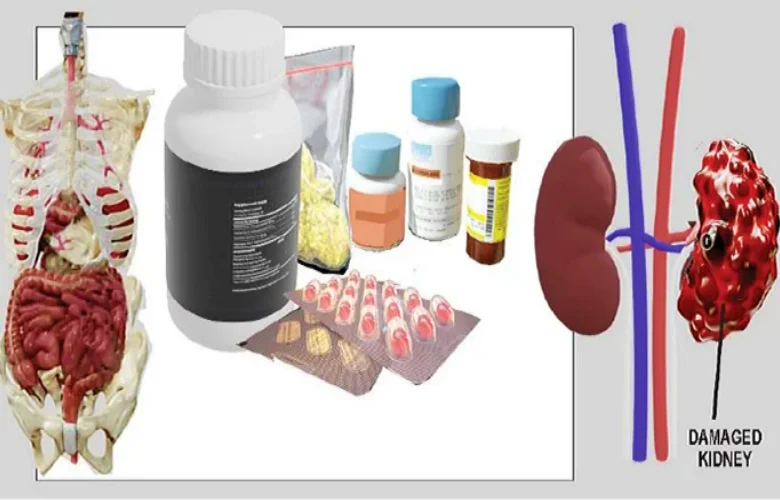 تلف الكلى الصامت الناتج عن تناول المكملات والفيتامينات