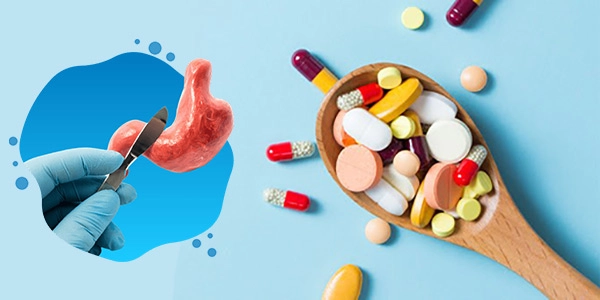 تناول الأدوية العلاجية بعد جراحات المعدة