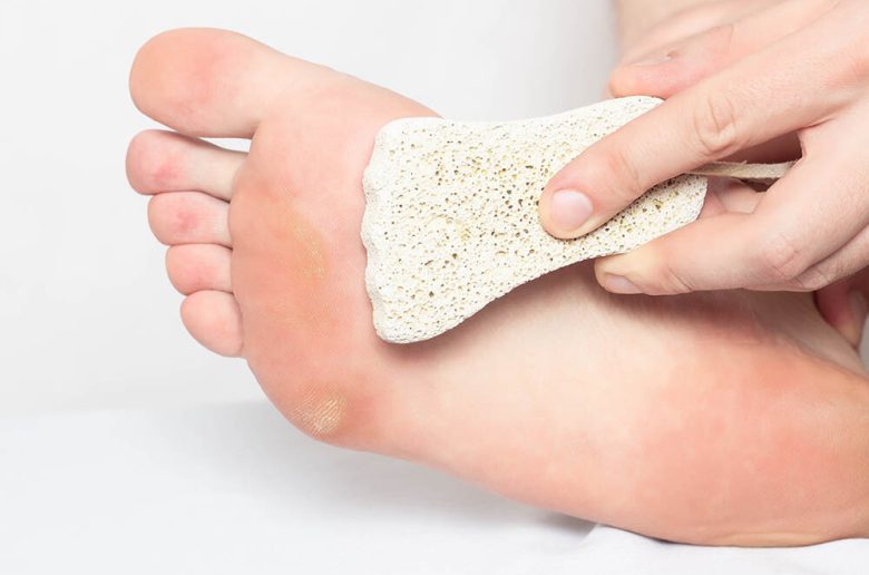 روتين منزلي للتغلب على ظهور الكالو في القدمين شتاءا