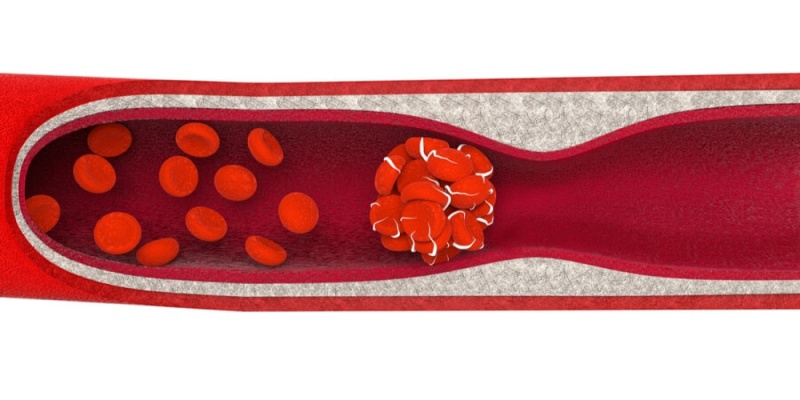 صعوبة مراقبة مؤشر تجلط الدم