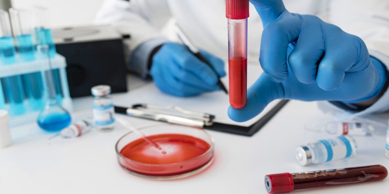 ما فائدة فحوصات الدم؟