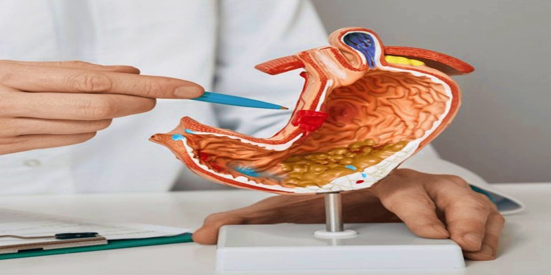 ما هي مضاعفات الإصابة بسرطان المعدة؟