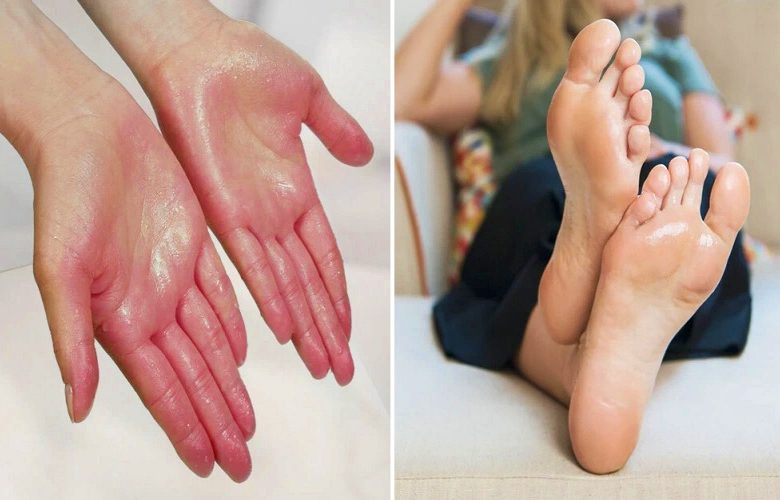 ما هي الأمراض التي يحذر منها التعرق المفرط في اليدين والقدمين؟