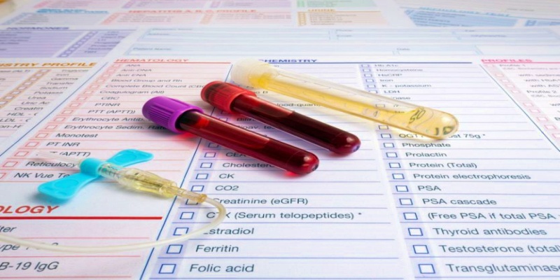 ما هي العوامل التي تؤثر على نتائج فحص الدم؟