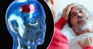 ماالمقصود بالسكتة الدماغية الإستيقاظية ؟