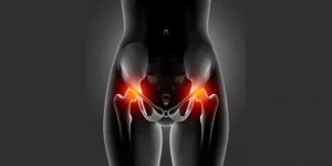 ماالمقصود بدوالي الرحم ؟