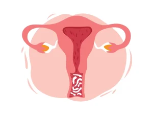 ماهي تأثير العدوى التناسلية على إمكانية حدوث حمل؟