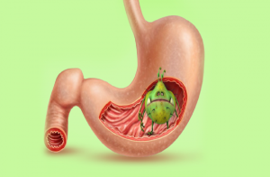 ماهي جرثومة المعدة التي تستمر 24 ساعة؟