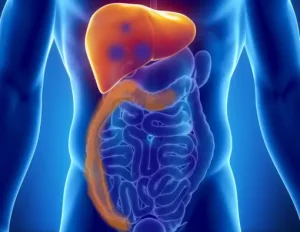 مدى شيوع سرطان القولون المنتشر في الكبد