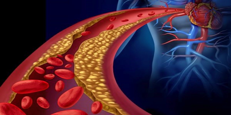 هل تستطيع الأنظمة النباتية أن تحد من نسب الدهون في الدم؟