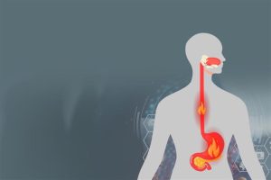 أدوية ارتجاع المرىء