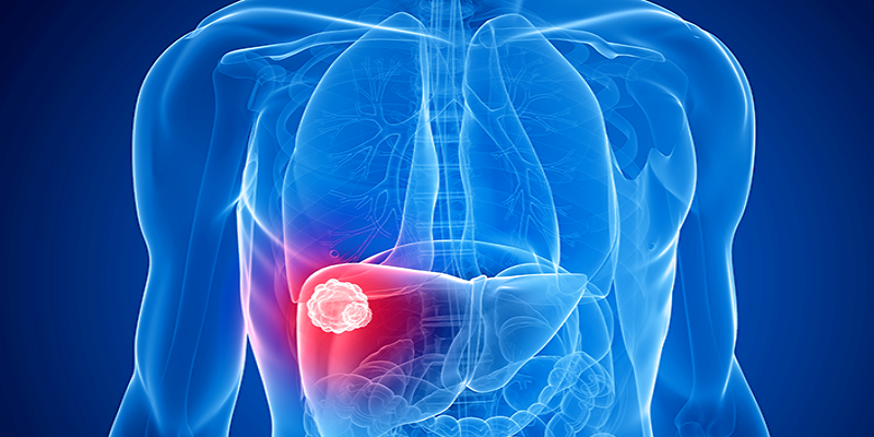 أسباب الإصابة بالورم الدموي الكبدي