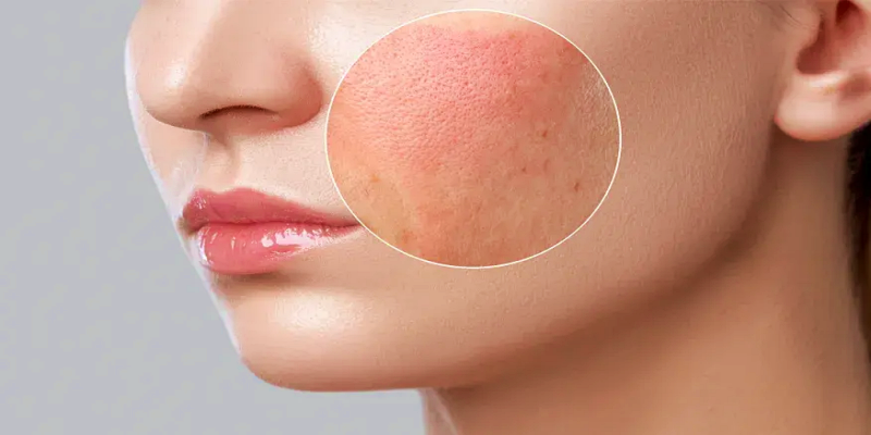 أسباب ردود الفعل السلبية التي تصيب البشرة عند تلقي العناية الزائدة