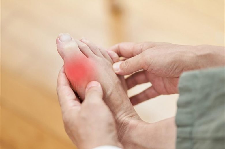 أعراض جلدية لمرض النقرس