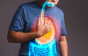 أعراض ضعف صمام المعدة