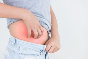 أعراض نموذجية للإصابة بالحزام الناري