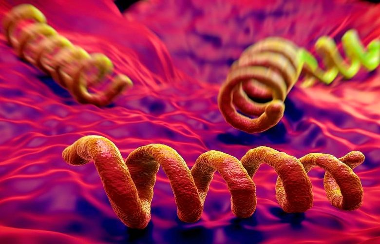 أكثر خمسة أسئلة شيوعا حول مرض الزهري