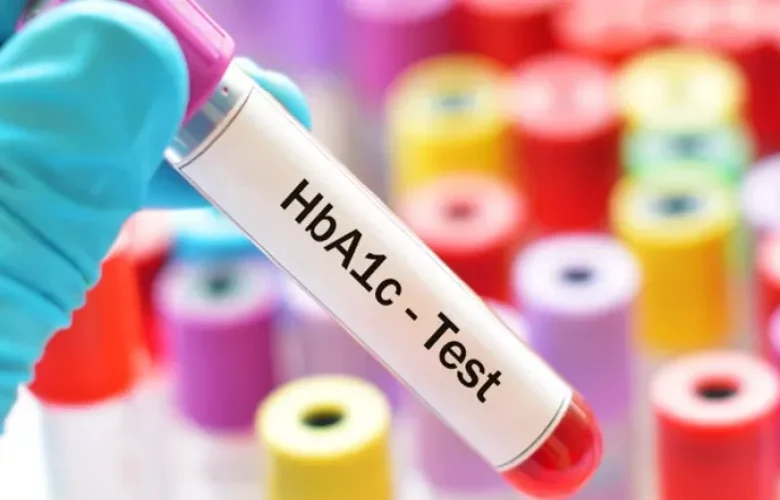 اختبار سكري الدم التراكمي