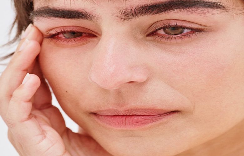 التهاب القزحية: الأسباب والأعراض وطرق العلاج