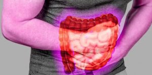 التهاب وتقرحات القولون