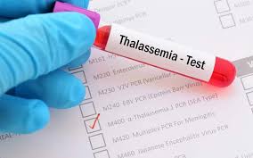 الثلاسيميا