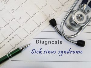 الخيارات العلاجية لمتلازمة خلل العقدة الجيبية