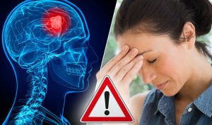 الصداع الناجم عن أورام الدماغ