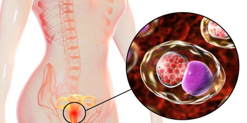 النساء المصابات بالكلاميديا