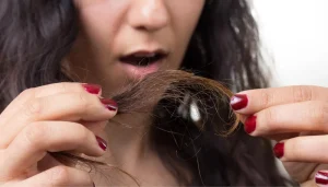 الوقاية من تقصف الشعر