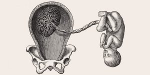 تلف المشيمة