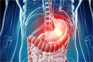 تهيج الغشاء المخاطي المبطن للجهاز الهضمي