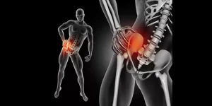 تيبس الوركين أثناء ممارسة التمارين الرياضية