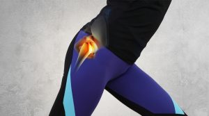 تيبس الوركين أثناء ممارسة التمارين الرياضية