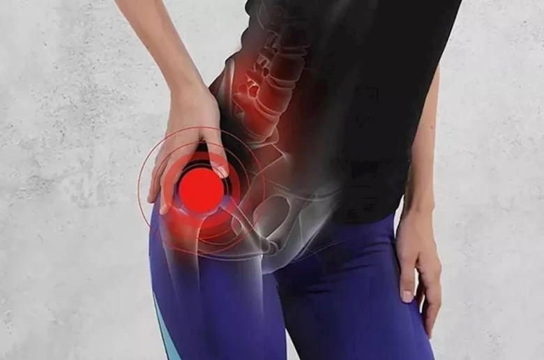 تيبس الوركين أثناء ممارسة التمارين الرياضية